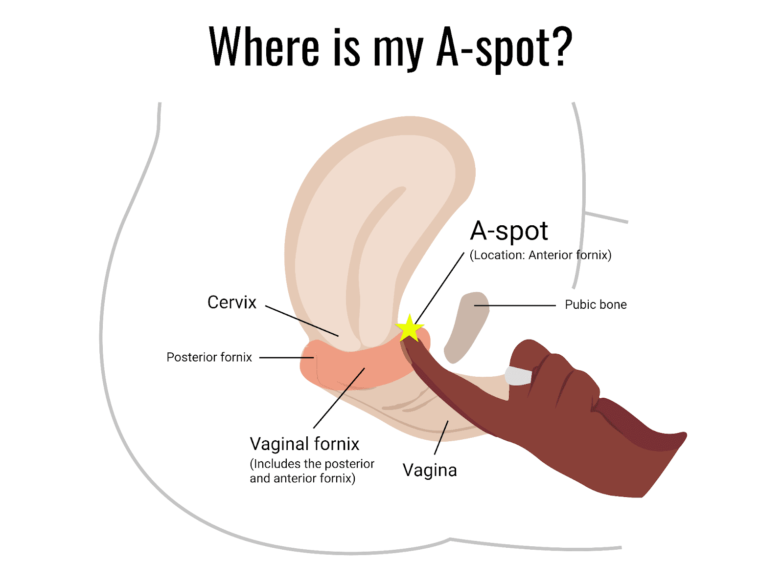 A-Spot Location diagram